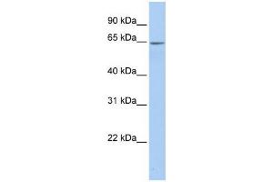 Human Placenta; WB Suggested Anti-ARSE Antibody Titration: 0. (Arylsulfatase E anticorps  (Middle Region))