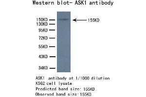 Western Blotting (WB) image for anti-Mitogen-Activated Protein Kinase Kinase Kinase 5 (MAP3K5) antibody (ABIN1873617) (ASK1 anticorps)
