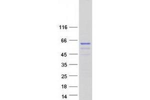 Validation with Western Blot