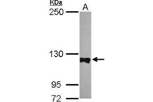 WB Image Sample (30 ug of whole cell lysate) A: HeLa 5% SDS PAGE antibody diluted at 1:5000 (PTPN12 anticorps  (N-Term))