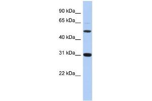 WB Suggested Anti-PI16 Antibody Titration: 0. (PI16 anticorps  (Middle Region))