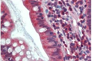Human Small Intestine: Formalin-Fixed, Paraffin-Embedded (FFPE) (CA1 anticorps  (AA 166-176))