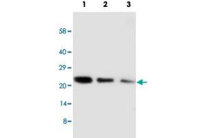 Western blot analysis of CDC42 recombinant protein with CDC42 polyclonal antibody . (CDC42 anticorps  (Internal Region))