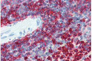 Spleen, Human: Formalin-Fixed, Paraffin-Embedded (FFPE)