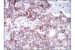 Immunohistochemistry (IHC) image for anti-Activated Leukocyte Cell Adhesion Molecule (ALCAM) (AA 48-216) antibody (ABIN1846221) (CD166 anticorps  (AA 48-216))