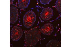 IF analysis of DYNLT1 using anti-DYNLT1 antibody (ABIN5693148).