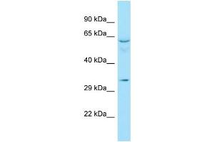 WB Suggested Anti-RAD51D Antibody Titration: 1. (RAD51D anticorps  (C-Term))