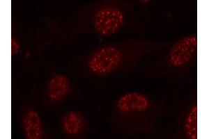 Immunofluorescence staining of methanol-fixed HeLa cells using Phospho-MAPKAPK2-T334 antibody (ABIN2988148). (MAPKAP Kinase 2 anticorps  (pThr334))