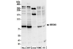 Western Blotting (WB) image for anti-SEC63 Homolog (SEC63) (AA 700-750) antibody (ABIN7449917)