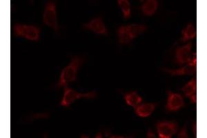 ABIN6274734 staining Hela by IF/ICC. (MRPL20 anticorps  (C-Term))