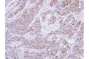 IHC-P Image Immunohistochemical analysis of paraffin-embedded SG xenograft , using BHMT, antibody at 1:100 dilution.