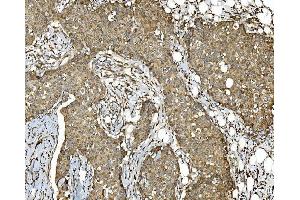 IHC analysis of PDIA5 using anti-PDIA5 antibody (ABIN7601801).