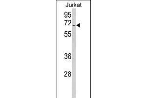 Western blot analysis of RBM14 Antibody (Center) (ABIN650783 and ABIN2839556) in Jurkat cell line lysates (35 μg/lane).