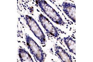 Immunohistochemistry of paraffin embedded human colon using ANKK1 (ABIN7073056) at dilution of 1:200 (400x lens)