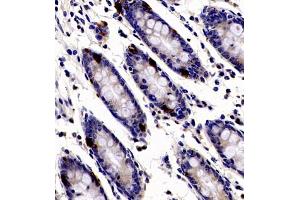 Immunohistochemistry of paraffin embedded human colon using ANKK1 (ABIN7073056) at dilution of 1:200 (400x lens) (ANKK1 anticorps)