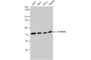 WB Image ZC3H12A antibody detects ZC3H12A protein by western blot analysis. (ZC3H12A anticorps)