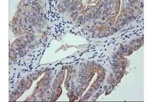 Image no. 3 for anti-Ring Finger Protein 39 (RNF39) antibody (ABIN1500723)