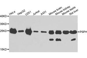 Western blot analysis of extracts of various cell lines, using PSPH antibody. (PSPH anticorps)