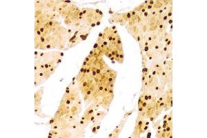 Immunohistochemistry of paraffin-embedded Human esophageal using Lamin A/C antibody.
