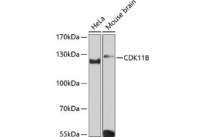 Western blot analysis of extracts of various cell lines, using CDK11B Antibody (ABIN6130092, ABIN6138305, ABIN6138306 and ABIN6216598) at 1:3000 dilution. (CDK11 anticorps  (AA 1-130))