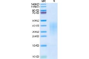 Interleukin 13 (IL13) (AA 19-132) protein (His tag)