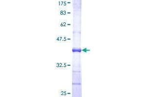Image no. 1 for UDP Glucuronosyltransferase 1 Family, Polypeptide A6 (UGT1A6) (AA 44-143) protein (GST tag) (ABIN1324580)