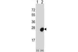 Western blot analysis of Mid1-interacting protein 1 (arrow) using rabbit polyclonal MID1IP1 Antibody  (N-term).
