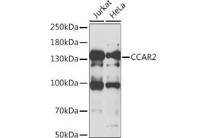 Western blot analysis of extracts of various cell lines, using CC antibody (ABIN6133528, ABIN6138034, ABIN6138035 and ABIN6222941) at 1:1000 dilution. (CCAR2 anticorps  (AA 654-923))
