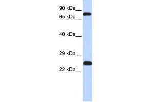 WB Suggested Anti-ZNF799 Antibody Titration:  0. (ZNF799 anticorps  (N-Term))