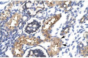 Human kidney; EHF antibody - N-terminal region in Human kidney cells using Immunohistochemistry (EHF anticorps  (N-Term))