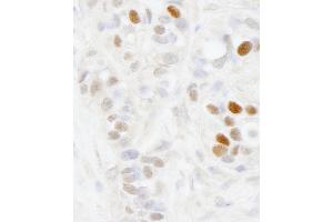 Immunohistochemistry (IHC) image for anti-Melanoma Antigen Family D, 2 (MAGED2) (AA 50-100) antibody (ABIN7448635) (MAGED2 anticorps  (AA 50-100))