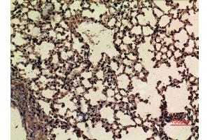 Immunohistochemistry (IHC) analysis of paraffin-embedded Mouse Lung, antibody was diluted at 1:100.