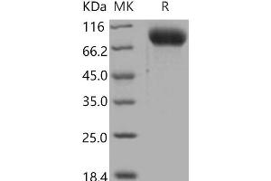 Western Blotting (WB) image for Intercellular Adhesion Molecule 1 (ICAM1) (Active) protein (His tag) (ABIN7320278)