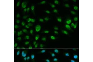 Immunofluorescence analysis of HeLa cells using MCM7 Polyclonal Antibody (MCM7 anticorps)