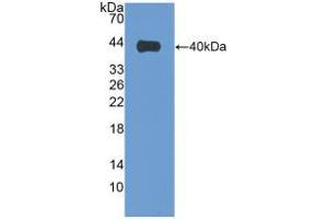 Western blot analysis of recombinant Human VIL1. (Villin 1 anticorps  (AA 1-320))