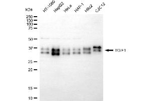 Western blotting analysis using TGIF1 antibody (ABIN7800535).