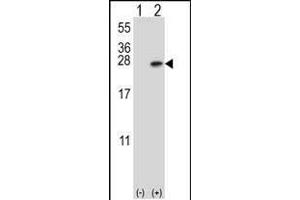 Western blot analysis of YWHAB (arrow) using rabbit polyclonal YWHAB Antibody (C-term) (ABIN392788 and ABIN2842226).