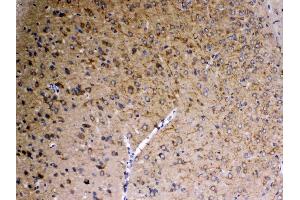 IHC analysis of SAP102 using anti-SAP102 antibody .