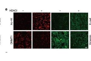 Acetylation of KGDNMT1impairs DNMT1-USP7 interaction and promotes the degradation of DNMT1.