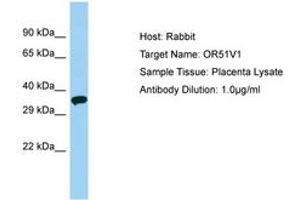 Image no. 1 for anti-Olfactory Receptor, Family 51, Subfamily V, Member 1 (OR51V1) (AA 206-255) antibody (ABIN6749901) (OR51V1 anticorps  (AA 206-255))
