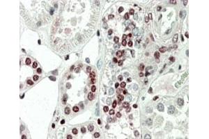 IHC staining of FFPE human kidney with PRAK antibody at 5ug/ml. (MAPKAP Kinase 5 anticorps)