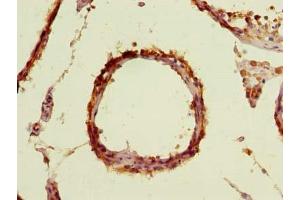 Immunohistochemistry of paraffin-embedded human testis tissue using ABIN7171606 at dilution of 1:100