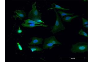 Immunofluorescence of purified MaxPab antibody to BUB1 on HeLa cell.