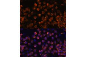 Immunofluorescence analysis of Raw264. (Complement Factor B anticorps  (AA 80-420))