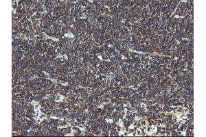 Image no. 13 for anti-Prefoldin Subunit 3 (PFDN3) antibody (ABIN1501704)