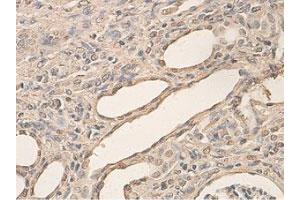 Immunohistochemical staining of formalin-fixed paraffin-embedded rat kidney tissue showing cytoplasmic and nuclear staining with AHR polyclonal antibody  at 1 : 200 dilution. (Aryl Hydrocarbon Receptor anticorps  (N-Term))