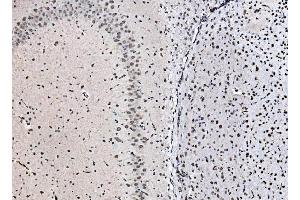 IHC analysis of DBC-1/CCAR2 using anti-DBC-1/CCAR2 antibody (ABIN7602235). (CCAR2 anticorps  (AA 65-917))