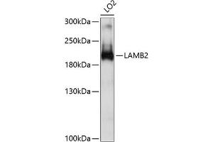 Western blot analysis of extracts of LO2 cells, using L antibody (ABIN6132095, ABIN6143070, ABIN6143071 and ABIN6214860) at 1:1000 dilution. (LAMB2 anticorps  (AA 1579-1798))