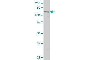 Image no. 3 for anti-ABL2 (ABL2) (AA 743-842) antibody (ABIN465946) (ABL2 anticorps  (AA 743-842))