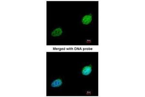 ICC/IF Image Immunofluorescence analysis of paraformaldehyde-fixed HeLa, using XPA, antibody at 1:200 dilution. (XPA anticorps  (Center))